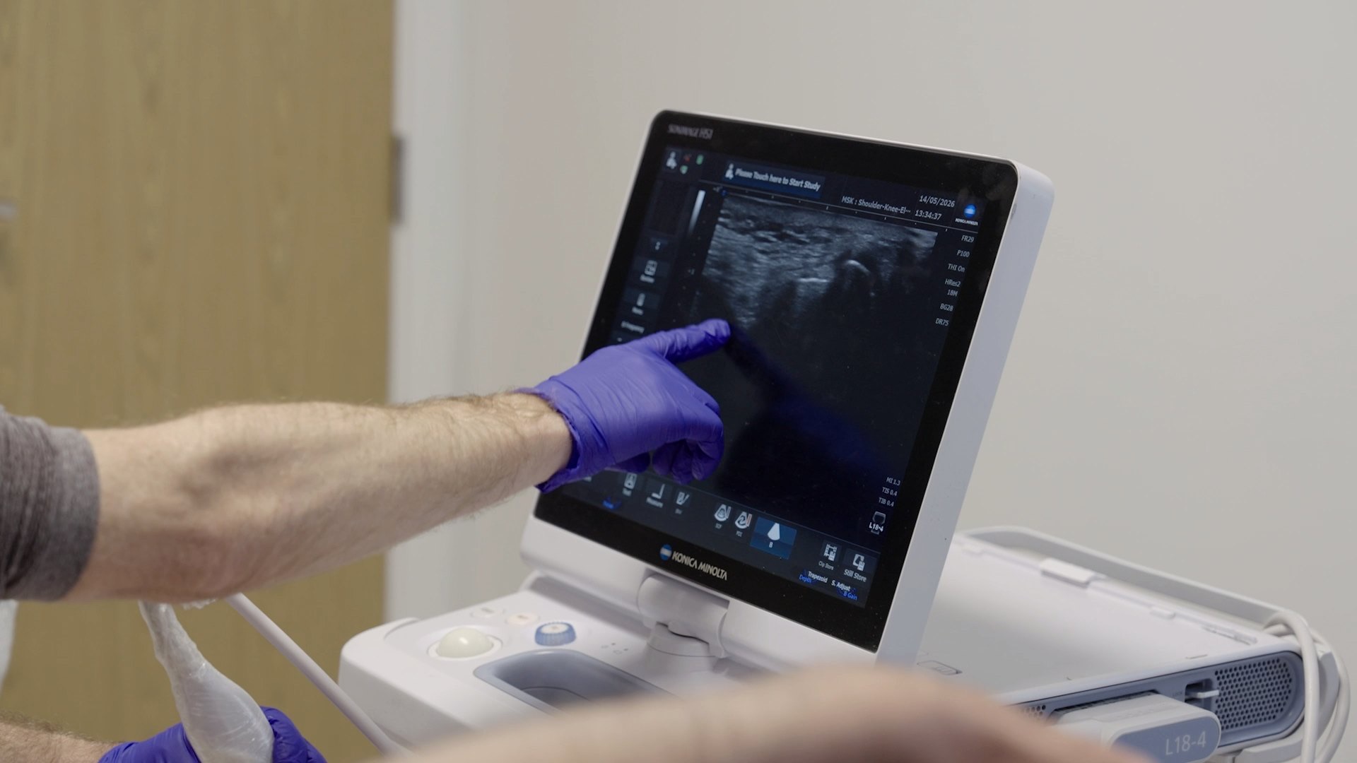 An ultrasound screen showing a scan of a joint during an appointment