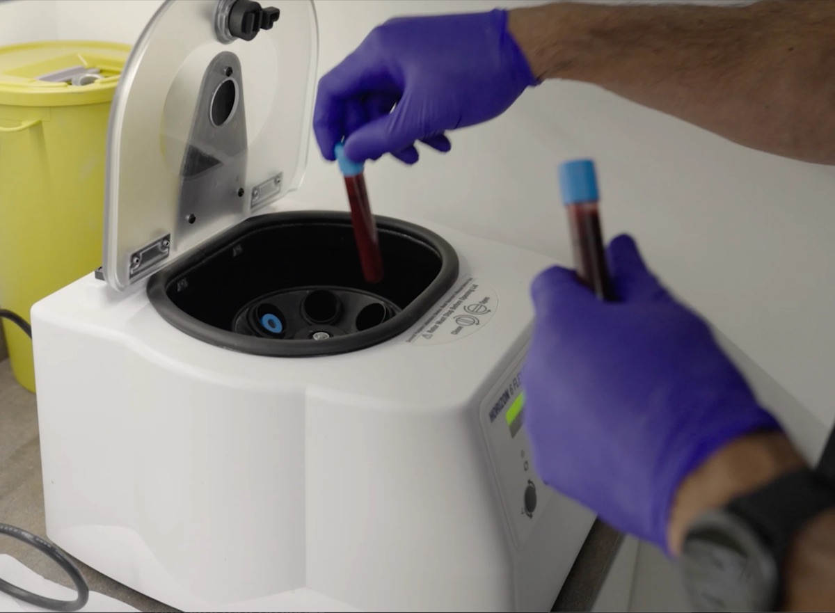 Blood samples being placed in a centrifuge to prepare platelet-rich plasma