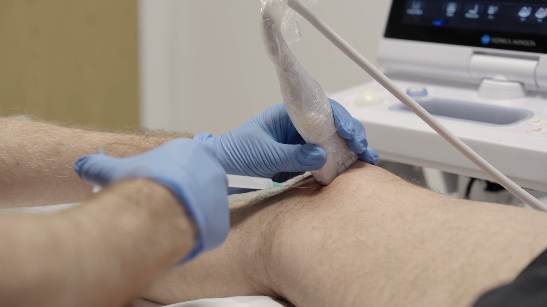 An ultrasound-guided knee injection