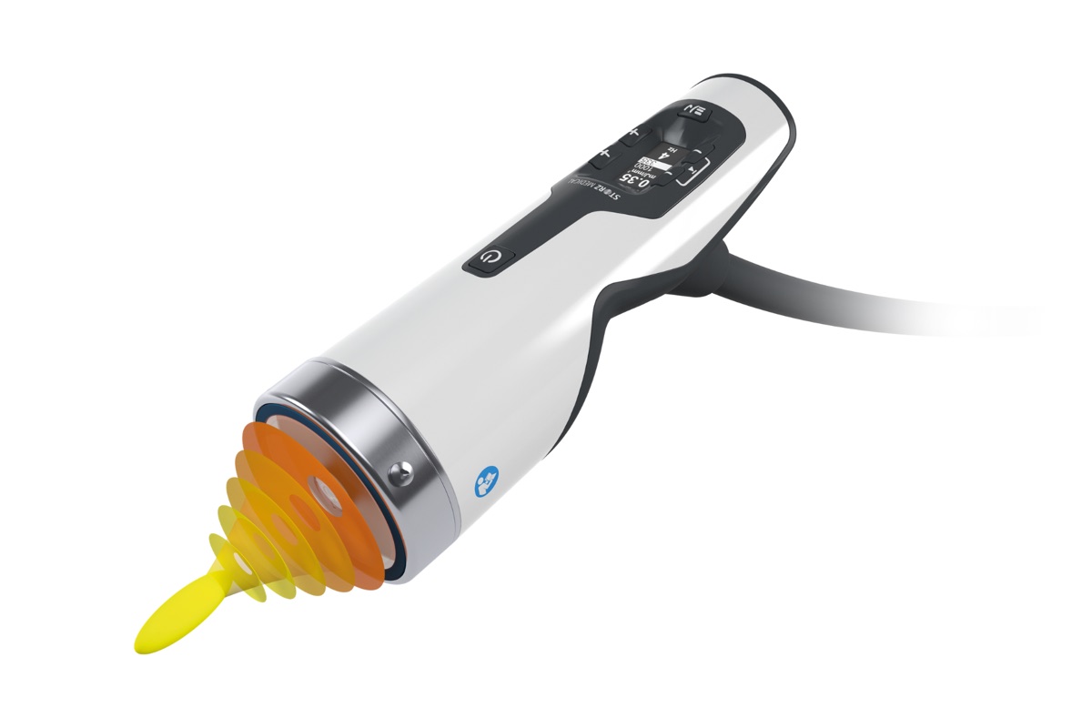 A Storz Medical focused shockwave handpiece, with the pulse shown narrowing to a point in front of the applicator